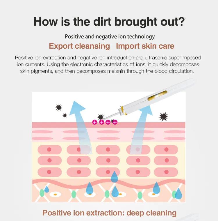 ULTRASONIC PORE EXTRACTOR - BeautifyFit
