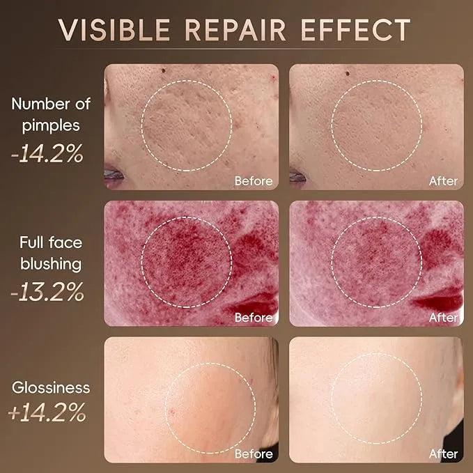 LumiGlow LED Skin Therapy Mask - BeautifyFit