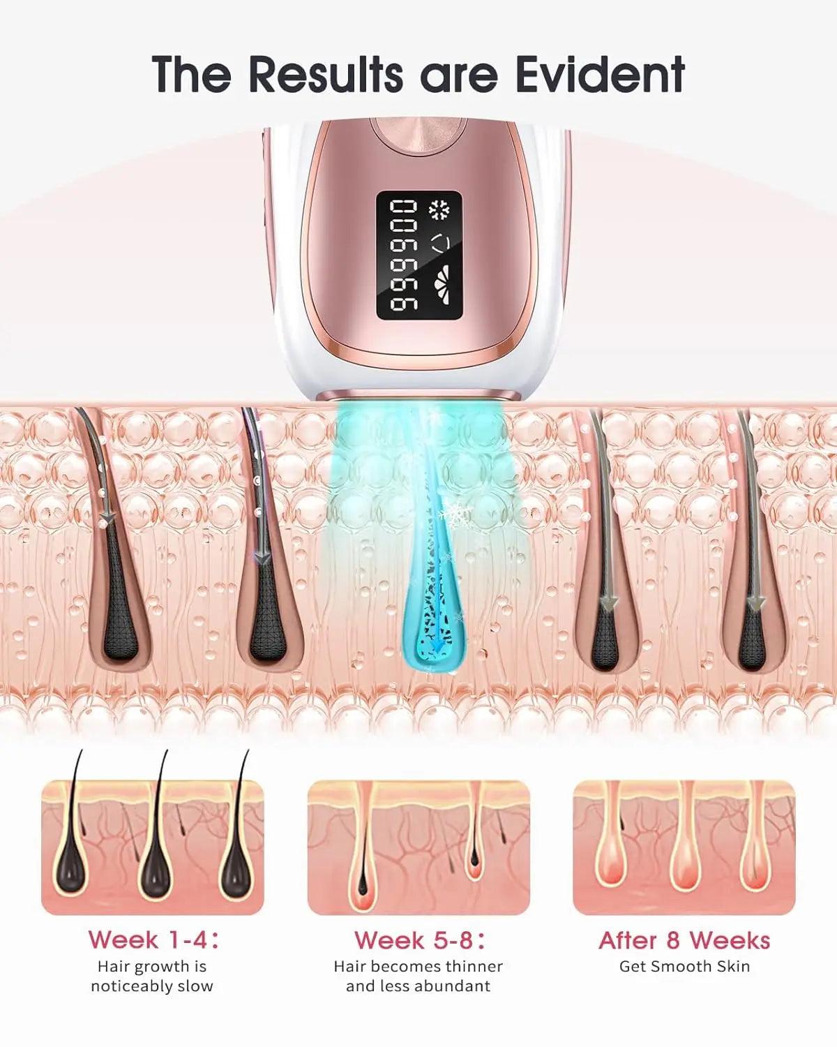 IPL LASER HAIR REMOVAL WITH COOLING - BeautifyFit