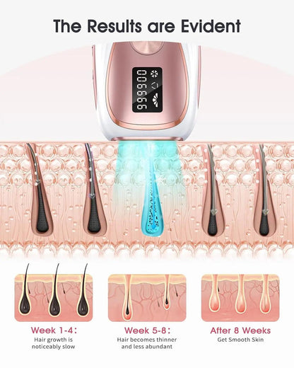 IPL LASER HAIR REMOVAL WITH COOLING - BeautifyFit