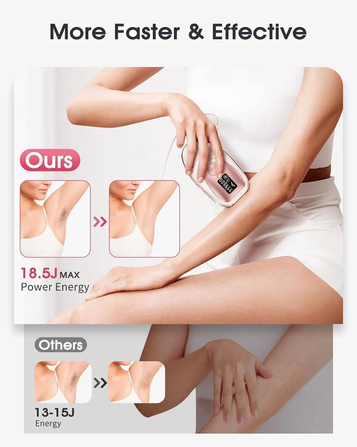 IPL LASER HAIR REMOVAL WITH COOLING - BeautifyFit