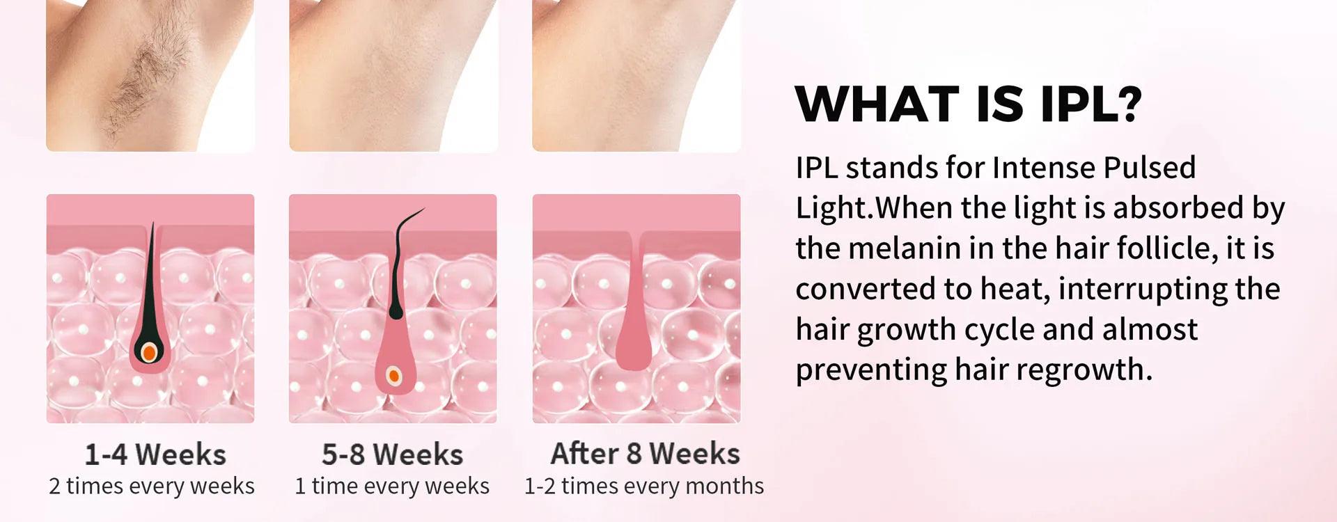 IPL LASER HAIR REMOVAL WITH COOLING - BeautifyFit