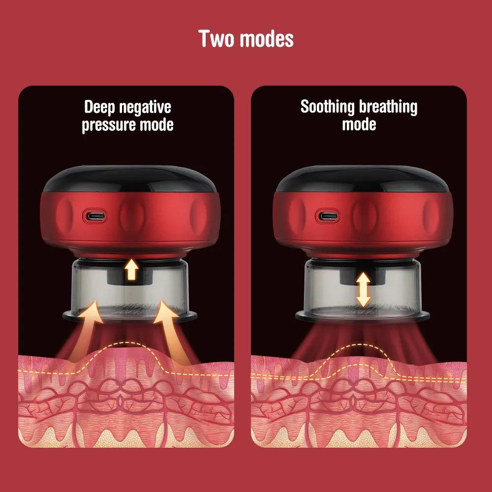 CUPPING MASSAGE THERAPY - BeautifyFit