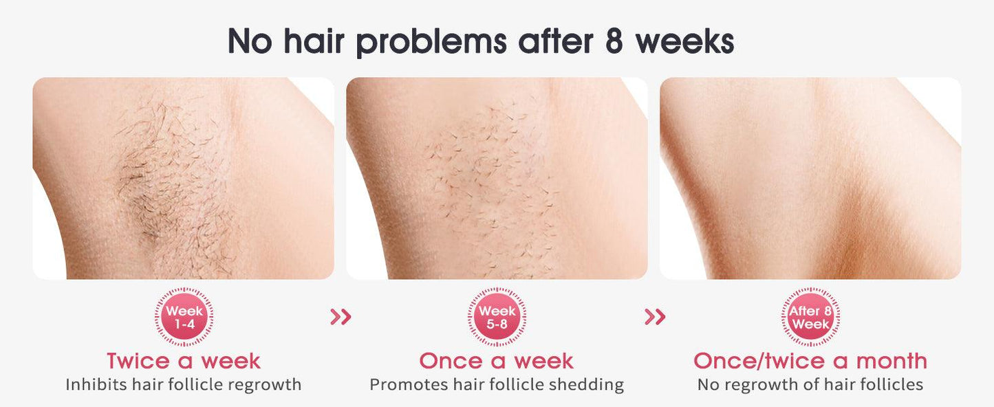 IPL LASER HAIR REMOVAL WITH COOLING - BeautifyFit